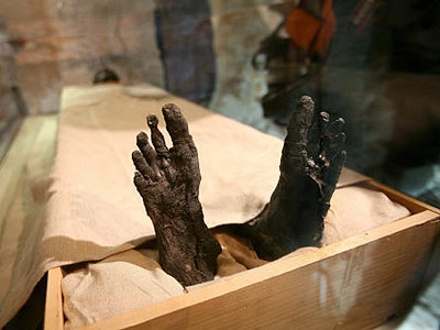 Bei der Freilegung der Mumie in den Jahren nach der Entdeckung des Grabes im Jahr 1922 durch Howard Carter wurde dem Knig bel mitgespielt: Kopf und Gliedmaen wurden vom Rumpf abgerissen. Die Besucher des Grabes bekommen von der Mumie nur Kopf und Fe zu Gesicht.  